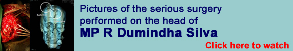 Photographs of the serious surgery performed on the head of MP R Dumindha Silva